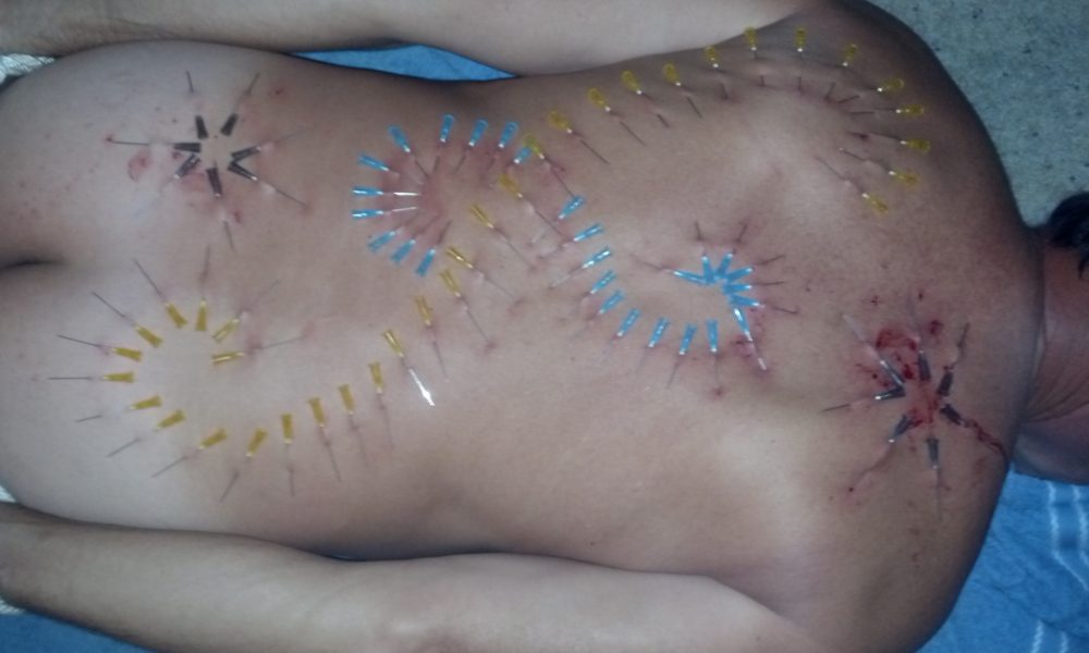 What Is Medical Play And Why Do People Have A Fetish And Love It?